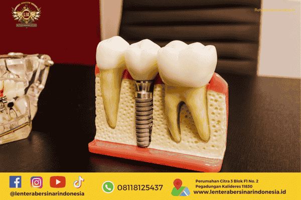 Efek Narkoba pada Kesehatan Gigi dan Mulut yang Jarang Dibahas